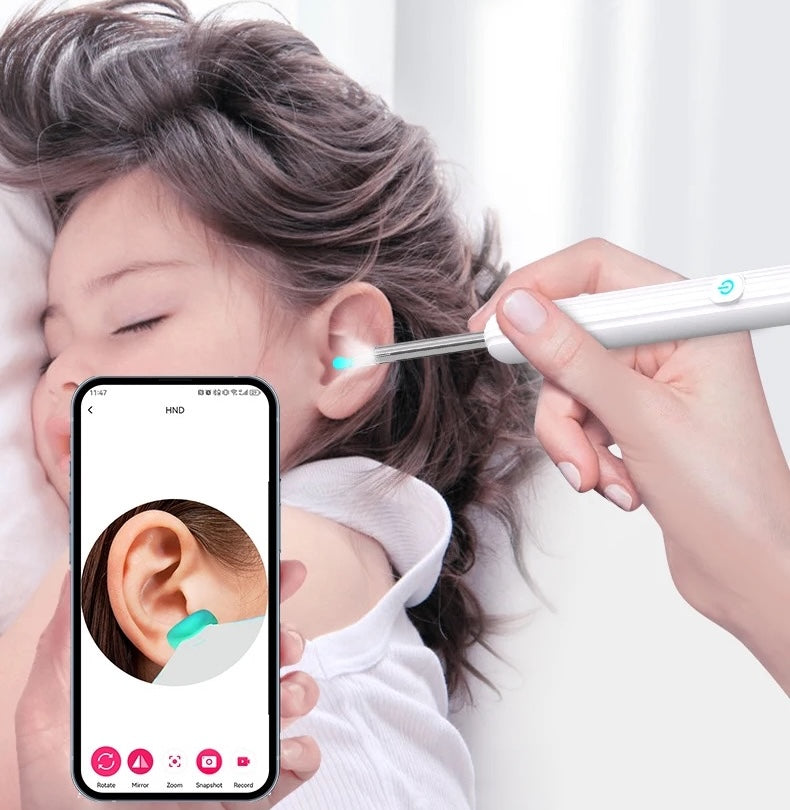 Otoscopio Limpiador de Oídos Youcare®